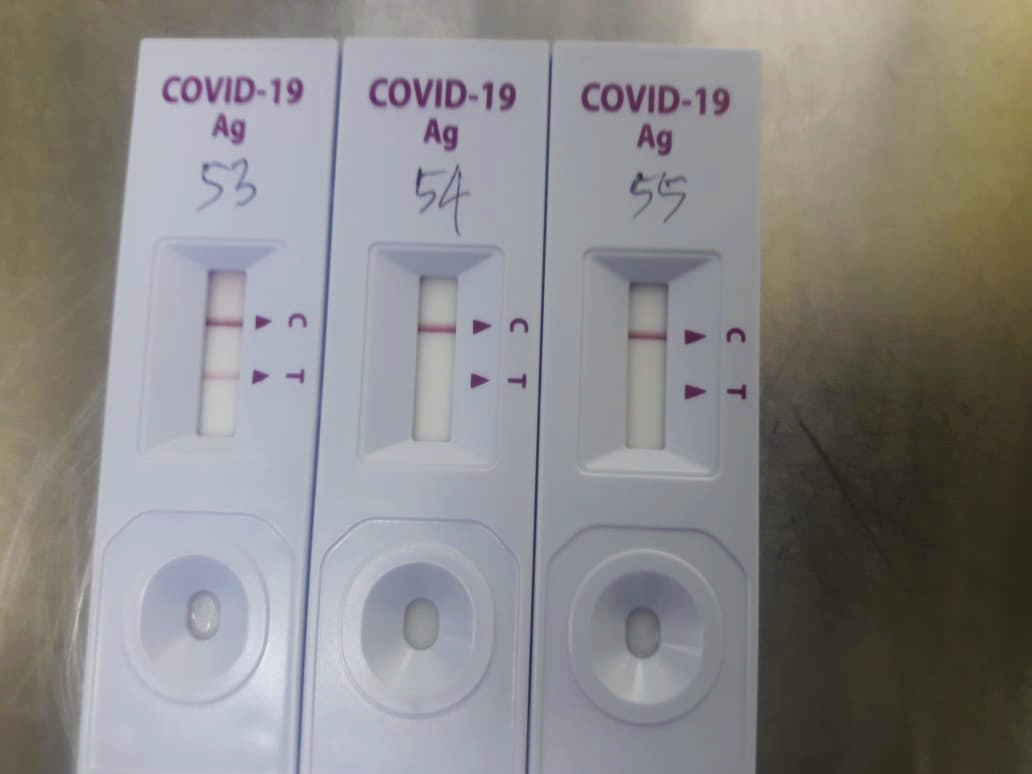 Teste de PCR vs Antígeno: Qual teste covid-19 é certo para mim?